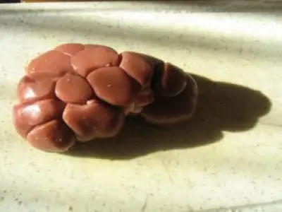 Recette Rognons de veau